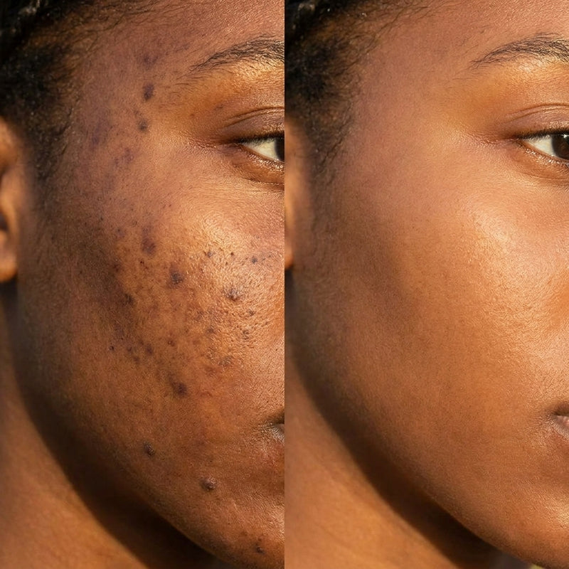 3. Real Results on Real Skin